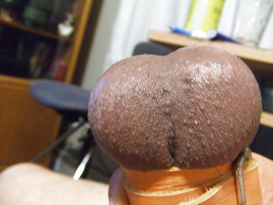 10P Milk Swollen Straped Balls 