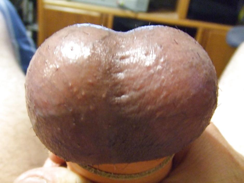 10P Milk Swollen Straped Balls 