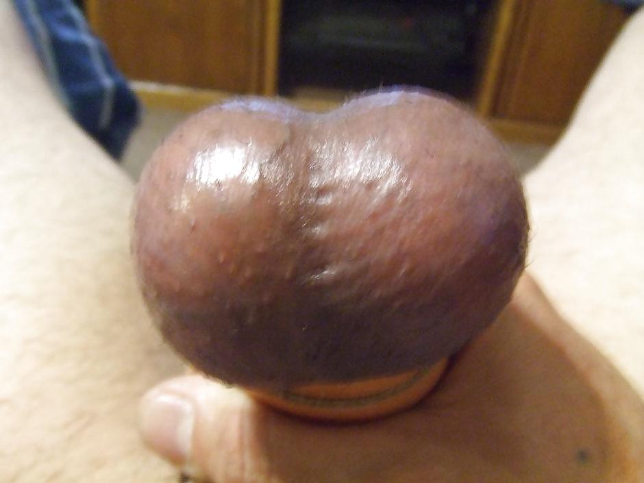 10P Milk Swollen Straped Balls 