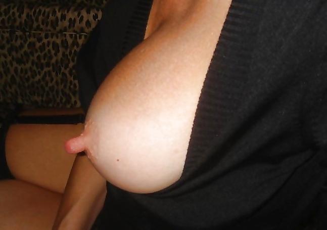 25P Giant Nipples