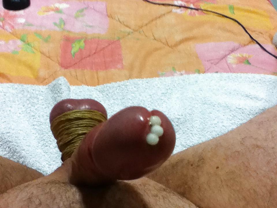9P Urethral Insertion