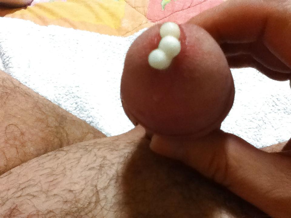 9P Urethral Insertion
