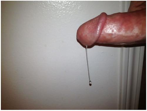 20P A Sticky Surprise!