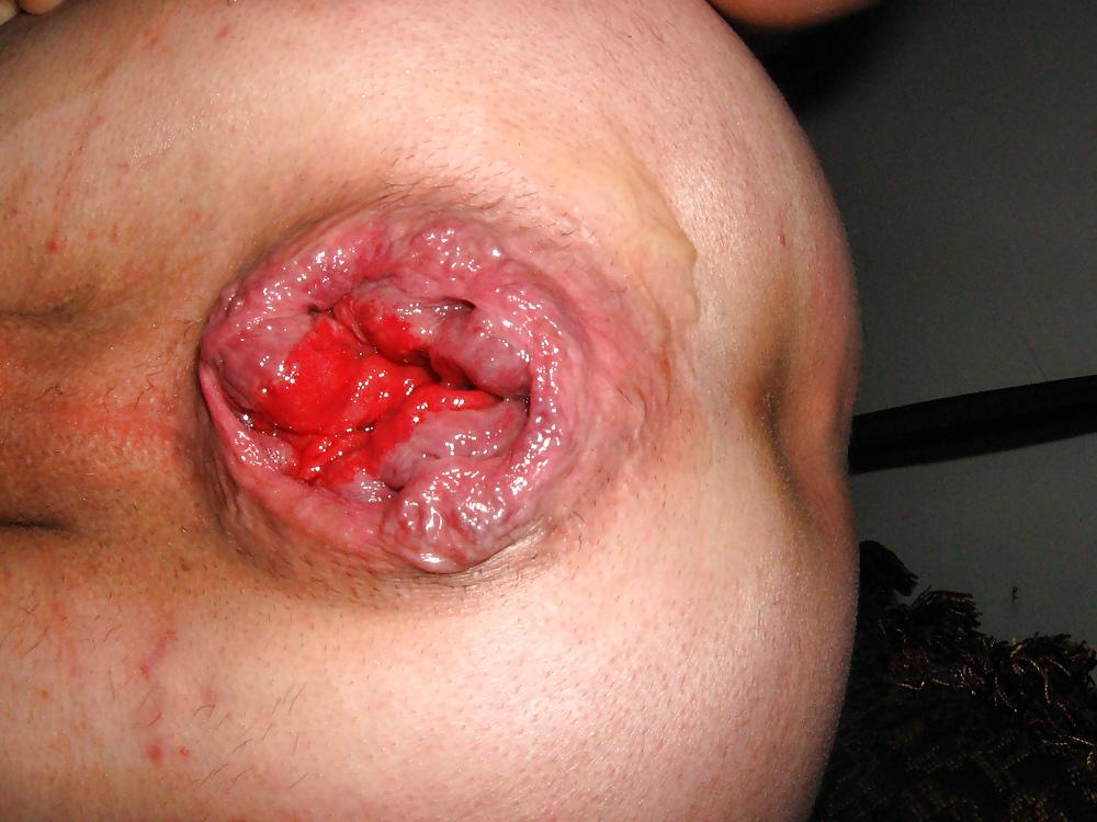 4P Extreme Hole