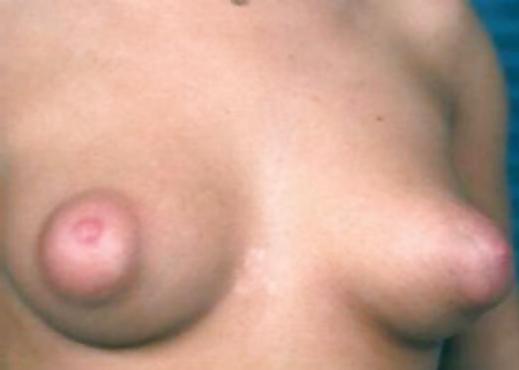 25P Some nice nipples 5