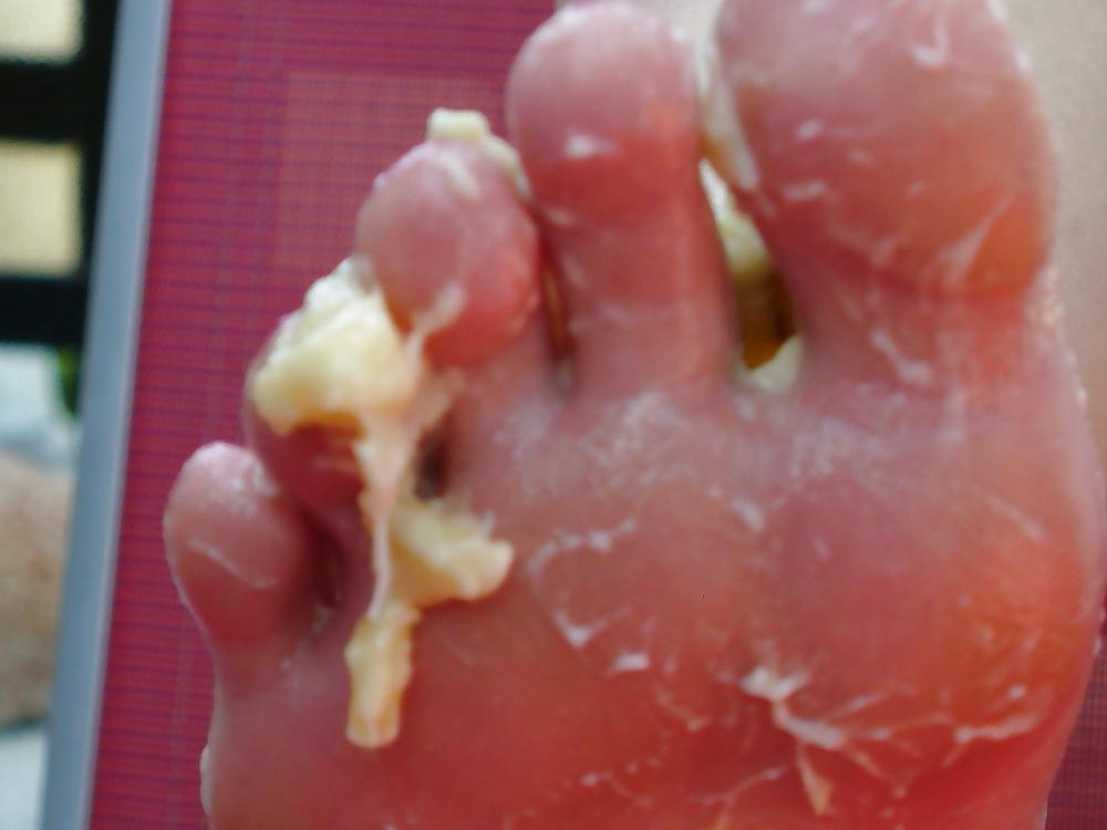 25P Barefeet and banana