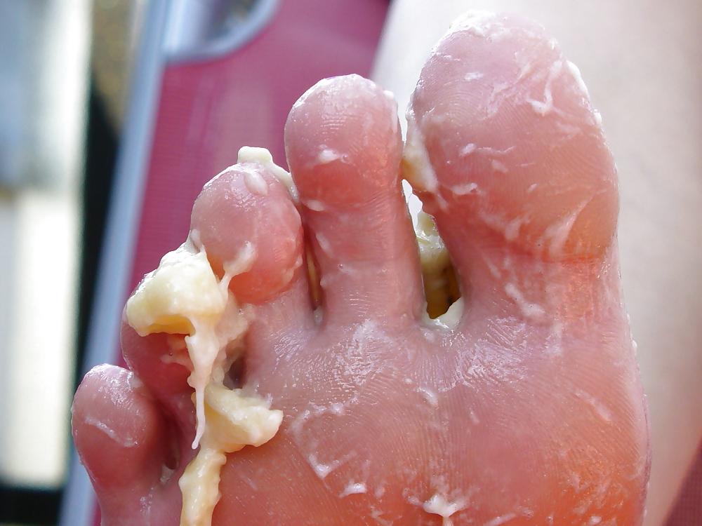 25P Barefeet and banana