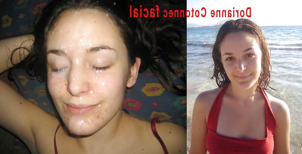16P Before and After Facials 2