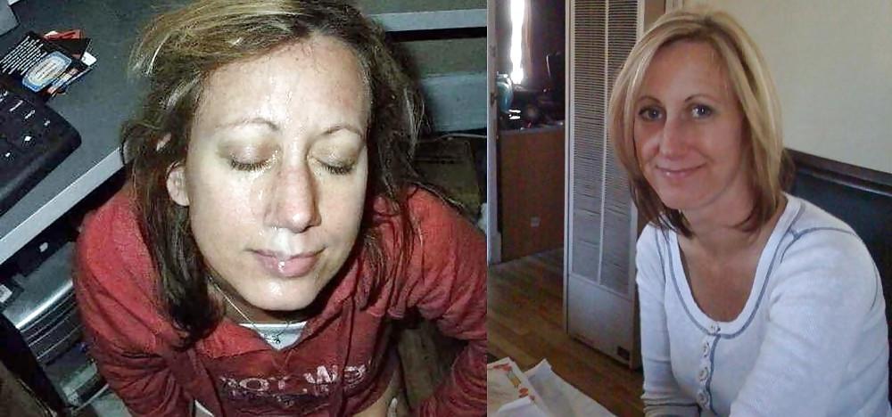 16P Before and After Facials 2