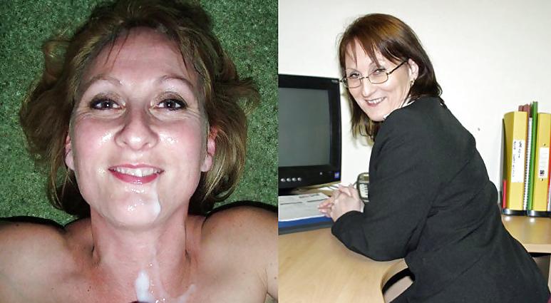 16P Before and After Facials 2