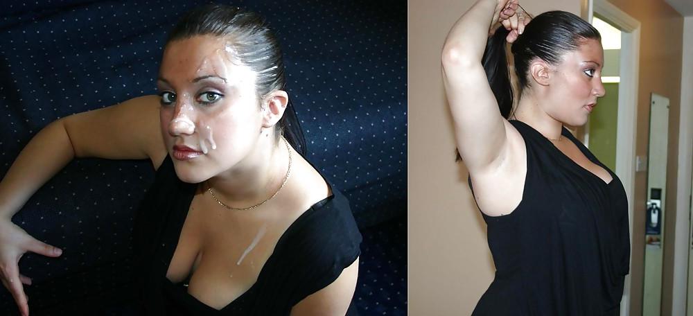 16P Before and After Facials 2