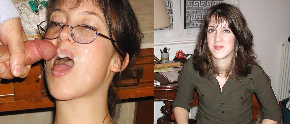 16P Before and After Facials 2