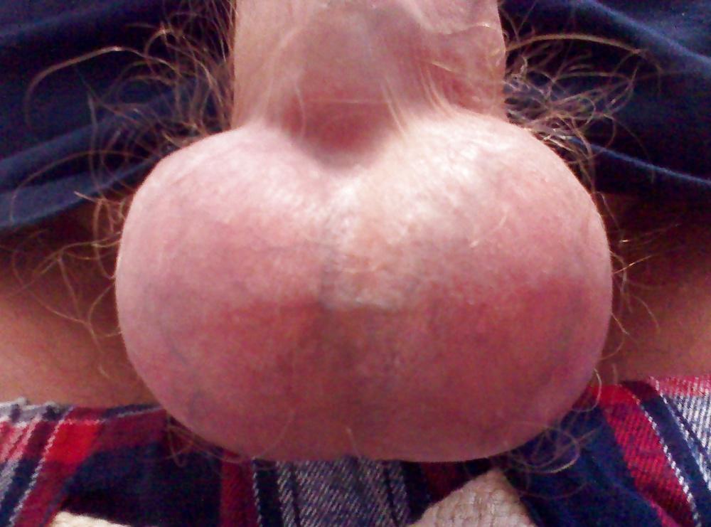 25P Tightly Bound Cock and Balls.