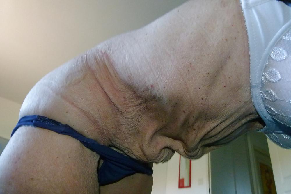 12P Mrs Antonia Xavier 78 yo is a retired teacher part 2