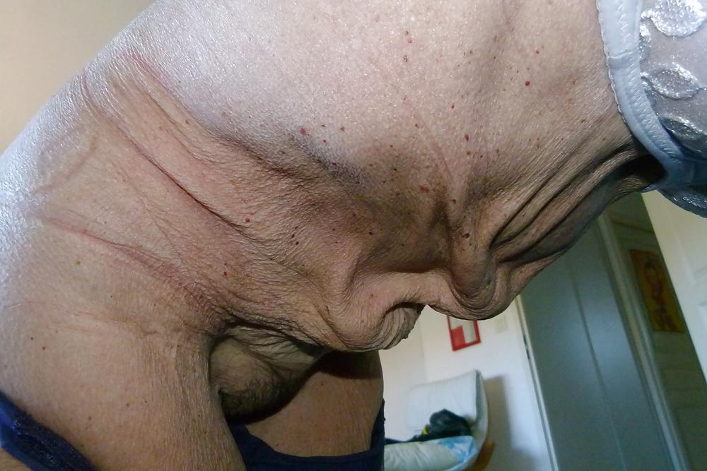12P Mrs Antonia Xavier 78 yo is a retired teacher part 2