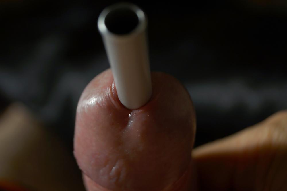 10P Insertion extreme