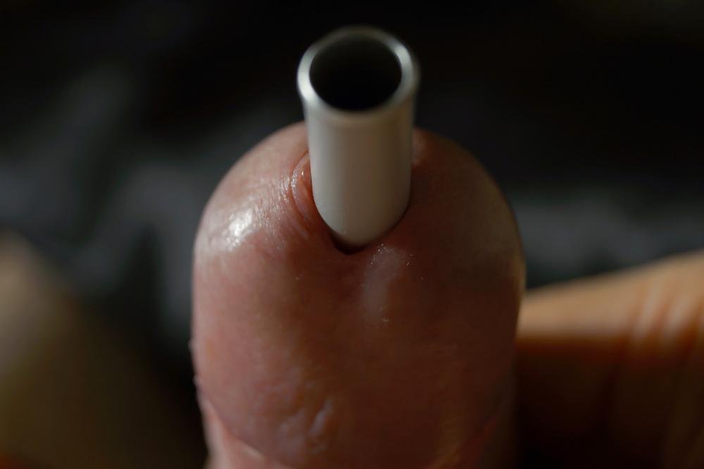 10P Insertion extreme