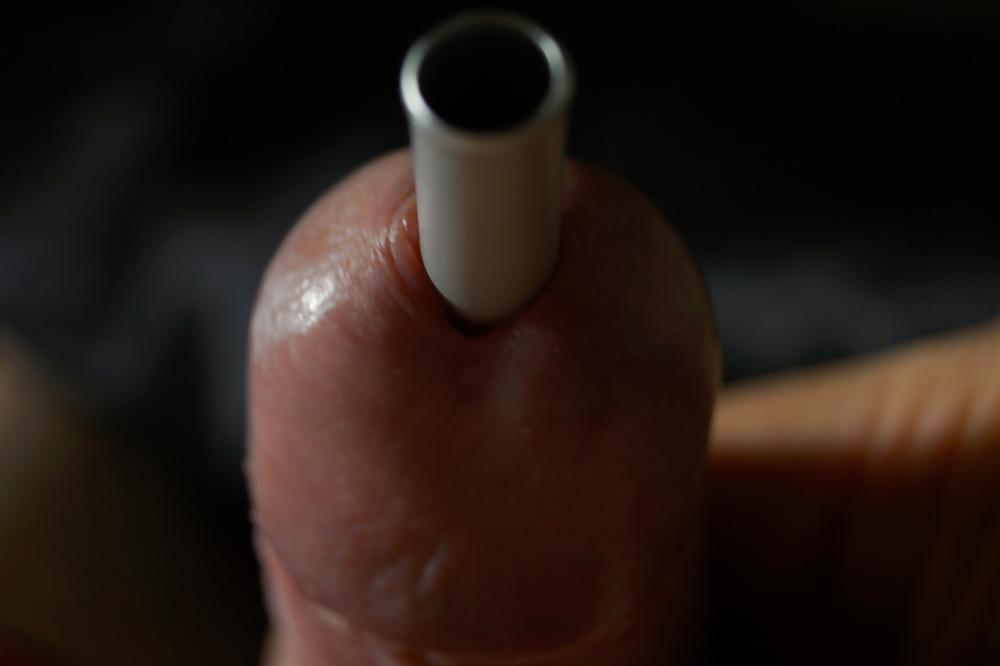 10P Insertion extreme