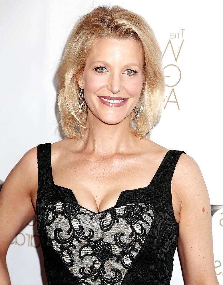 24P Anna Gunn - Bitchy MILF of Breaking Bad