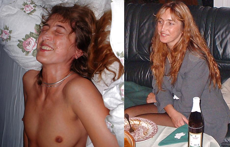 23P Before and After Facials #3 - Dressed and Undressed