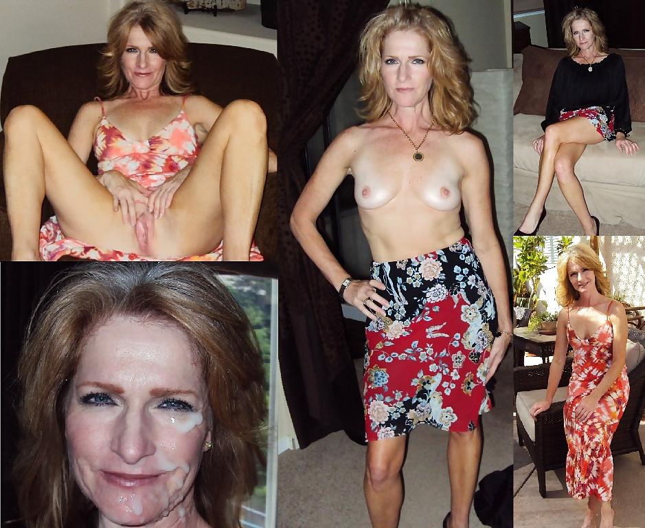 23P Before and After Facials #3 - Dressed and Undressed