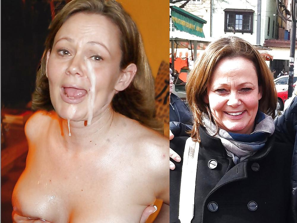 23P Before and After Facials #3 - Dressed and Undressed