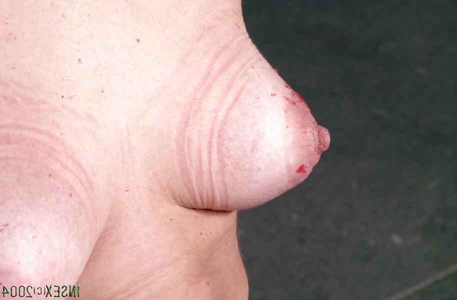 25P Bound breasts