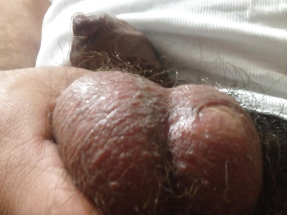 22P Balls and dick 