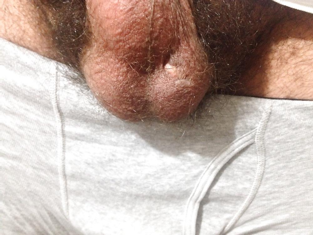 22P Balls and dick 