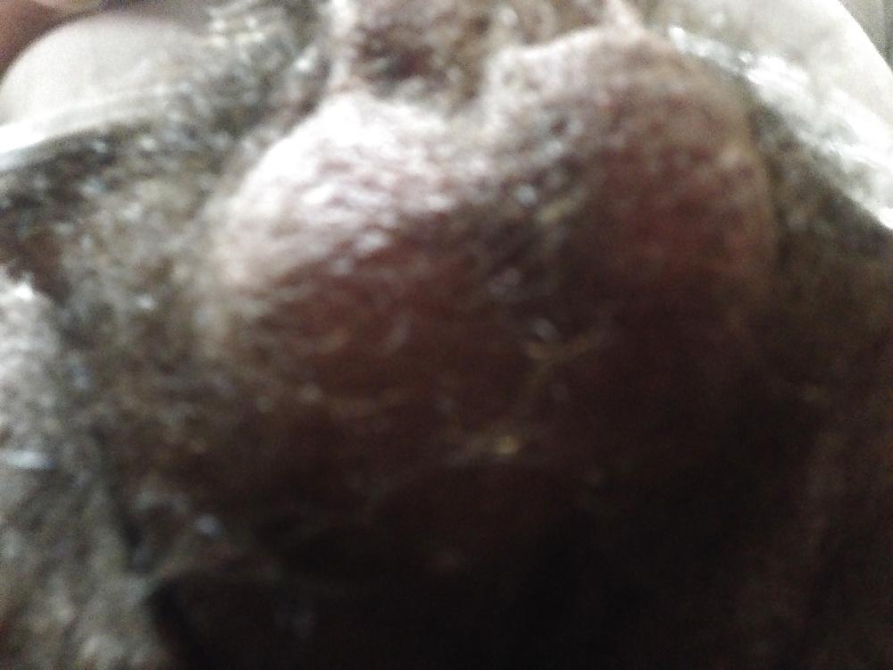 22P Balls and dick 