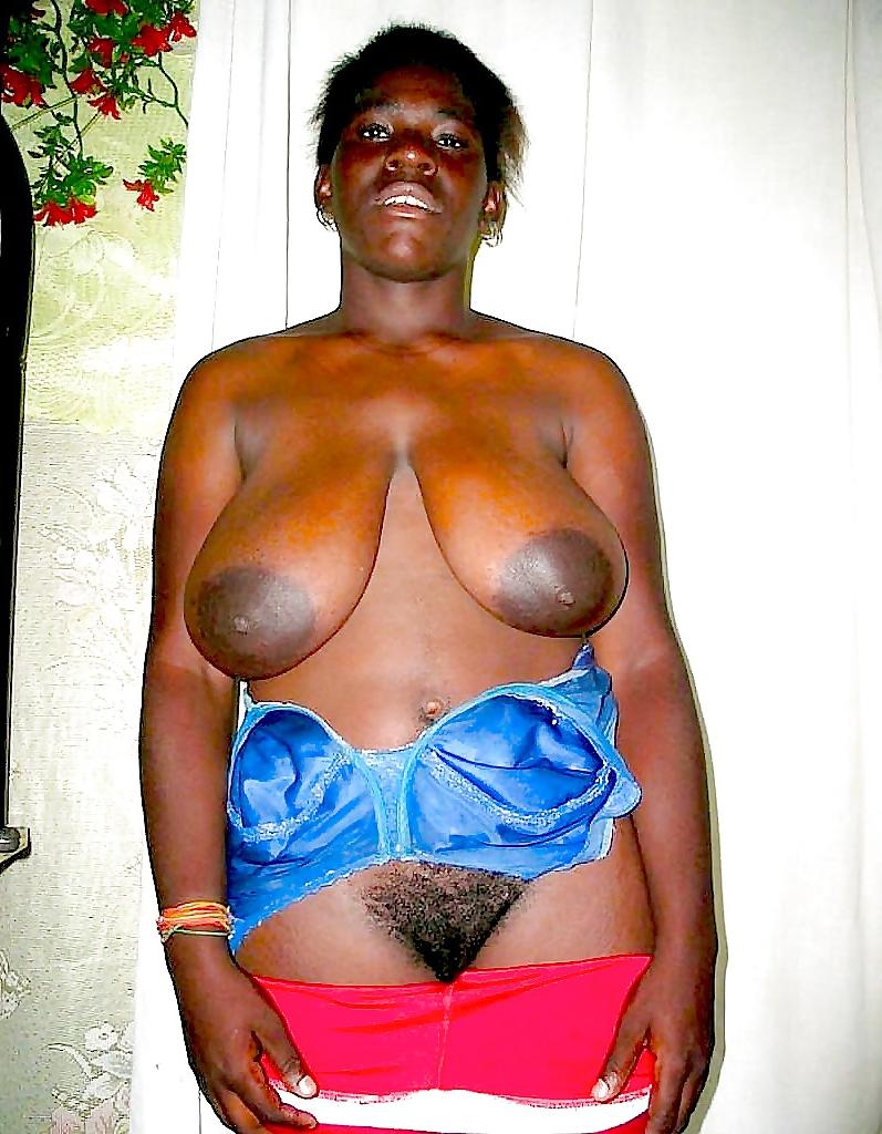20P Areolas And Nipples: Big And Thick#35