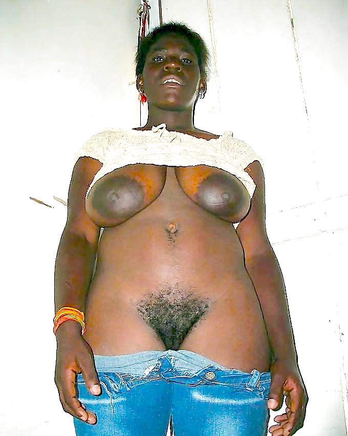 20P Areolas And Nipples: Big And Thick#35