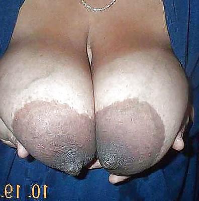 15P Areolas And Nipples: Big And Thick#43