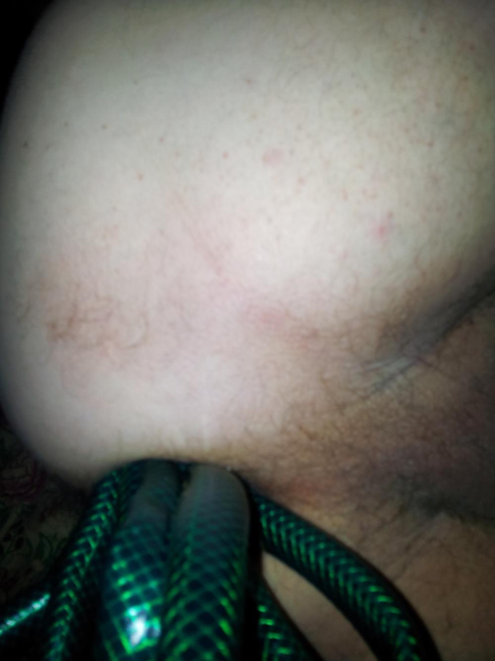 24P My ass , my tiny cock, my tiny ball