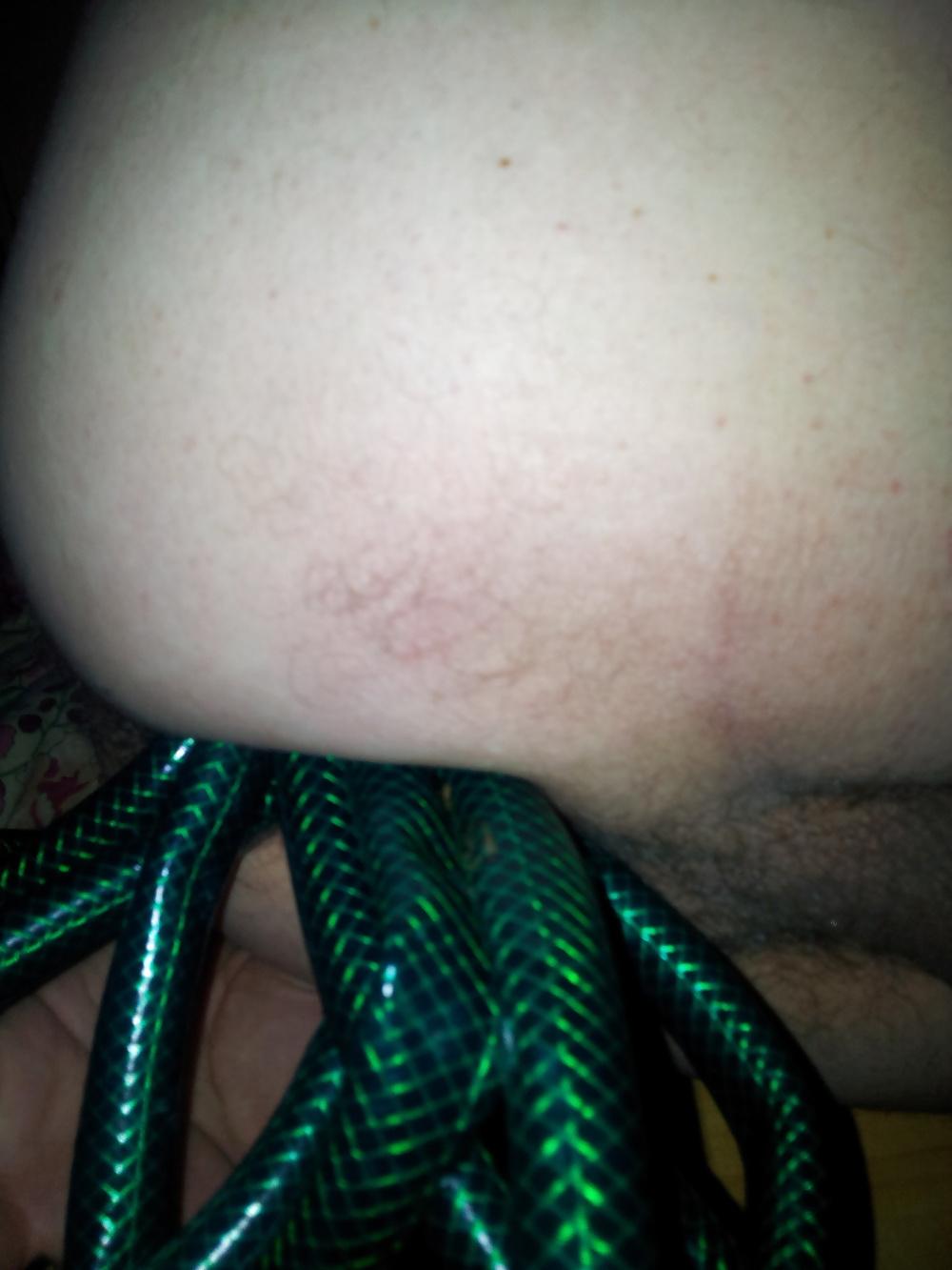 24P My ass , my tiny cock, my tiny ball