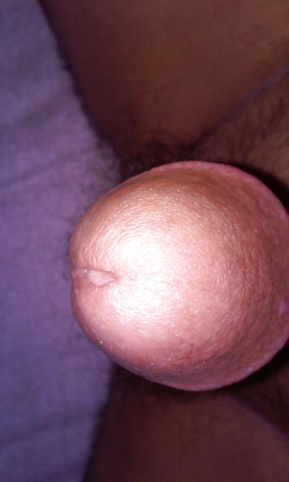 6P Pre cum
