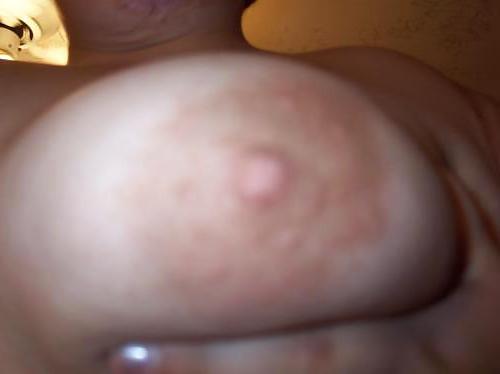 24P Yummy Nipples