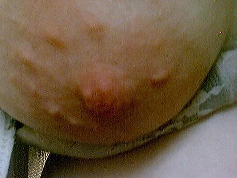 24P Yummy Nipples
