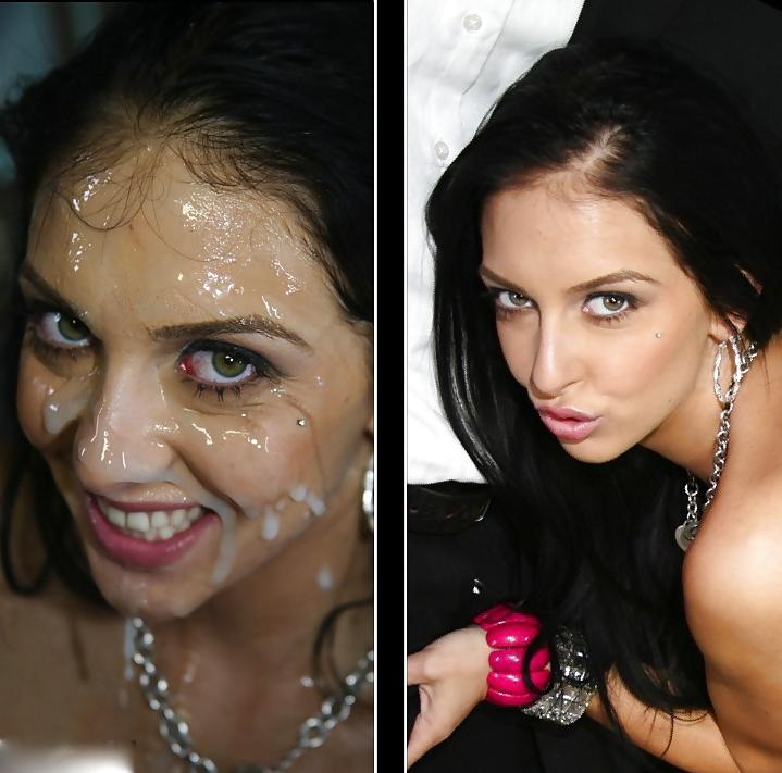 25P Before and After Facials