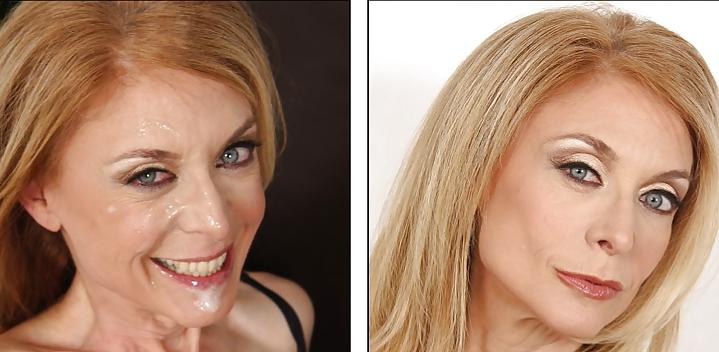 25P Before and After Facials