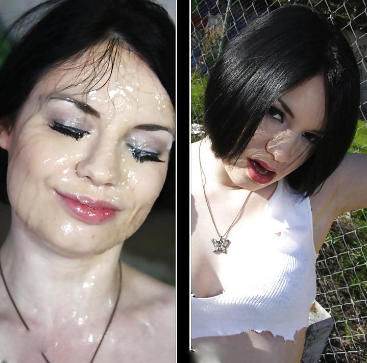 25P Before and After Facials