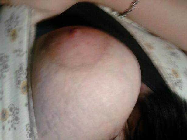 8P Big Tetas