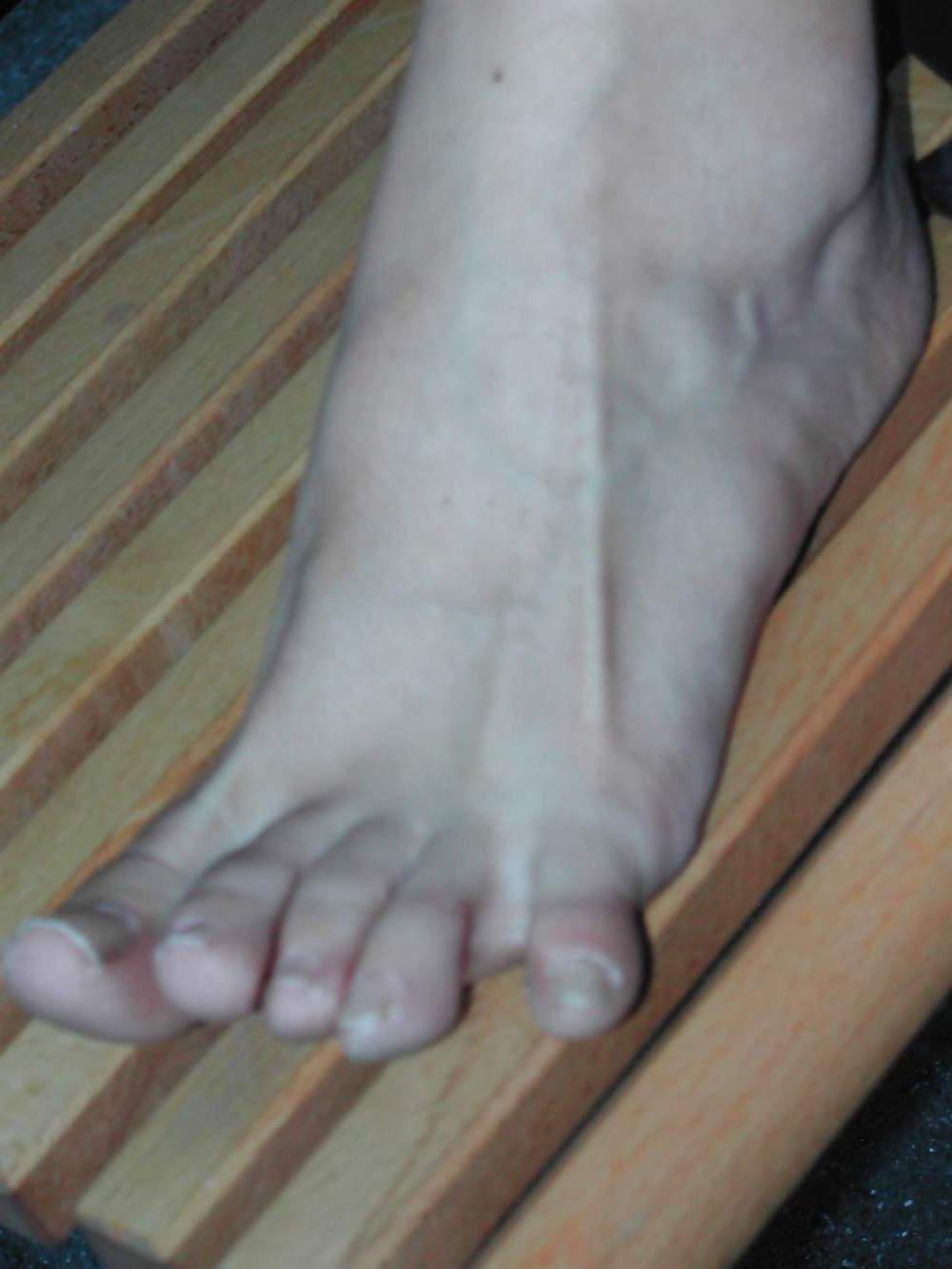 24P Swiss girls feet