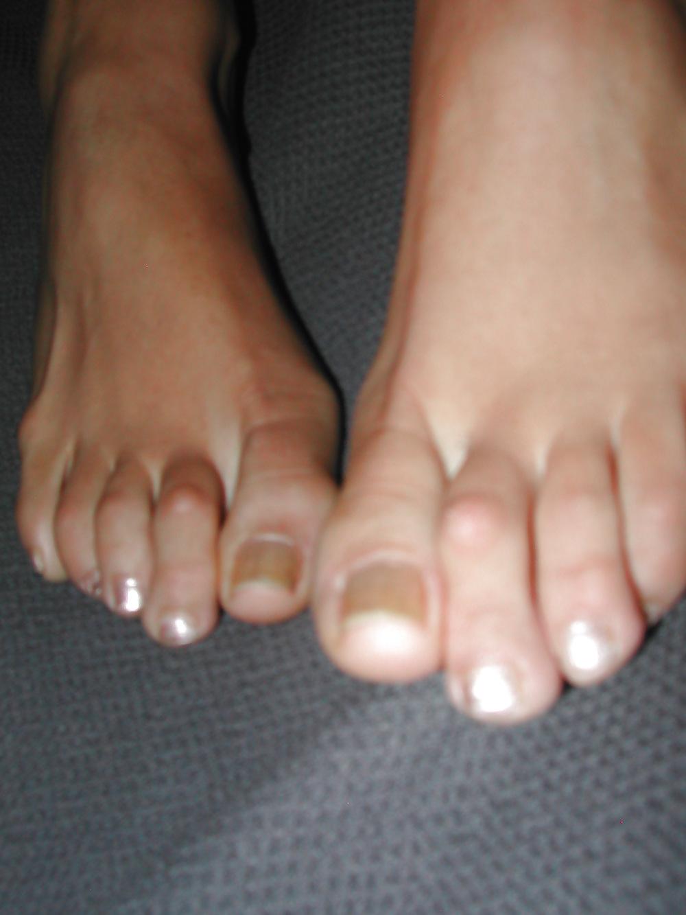 24P Swiss girls feet