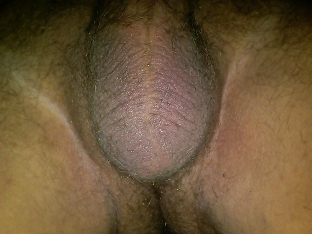 15P Phone & Webcam Pics of My Balls and Cock