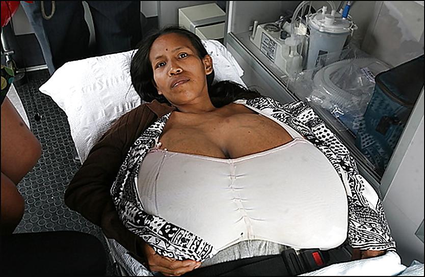 25P X-treme big tits!