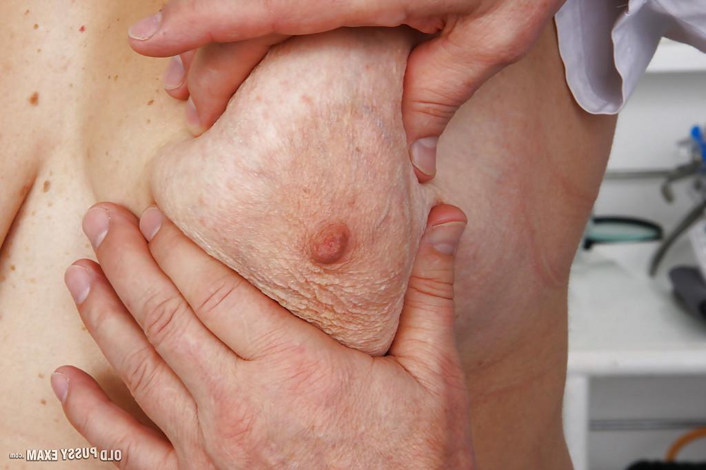 16P Mature fatty with hairy pussy receiving enema from gyno doctor