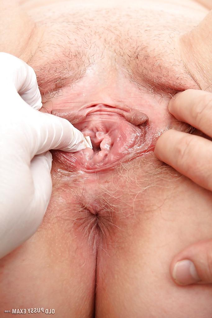 16P Gyno sex scene with mature lady Ester and her local doctor