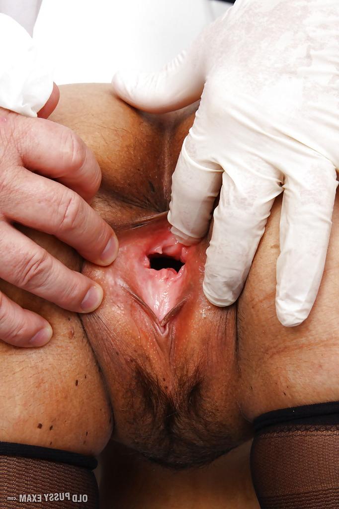 16P Stocking garbed mature woman Rosita Black having beaver spread by Gyno doc