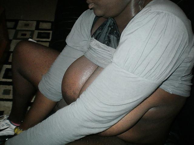 25P Worlds hairest ghetto ass!!!!